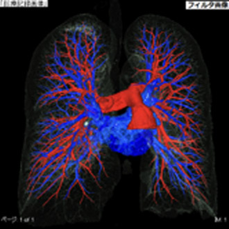 ⑤肺動静脈分離