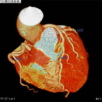 ⑥心臓CT