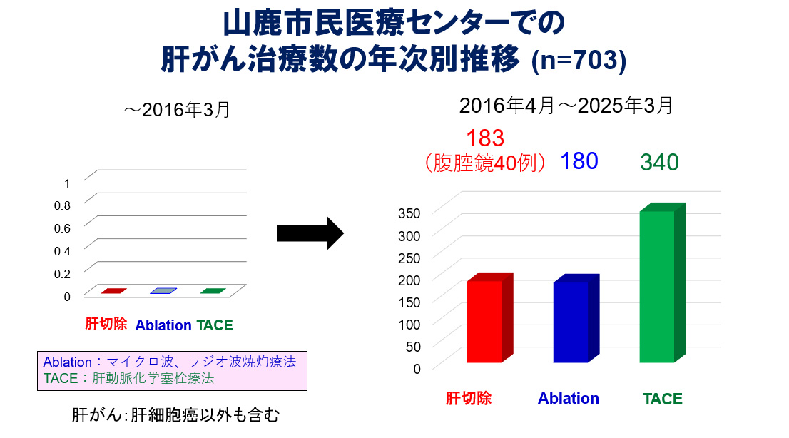 山鹿市民医療センターでの肝がん治療数の年次別推移のグラフ。2016年3月までの肝切除、マイクロ波・ラジオ波焼灼療法、肝動脈化学塞栓療法の年でみたそれぞれの治療数は0です。2016年4月~2025年3月は肝切除は183件。その中で腹腔鏡40件、マイクロ波・ラジオ波焼灼療法は180件、肝動脈化学塞栓療法は340件になっています。