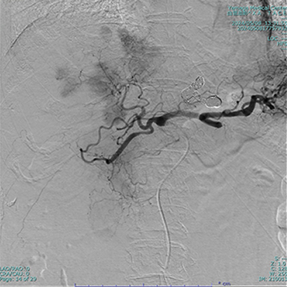血管造影装置の検査画像例