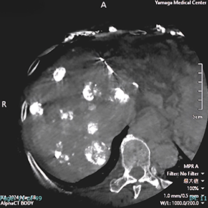 血管造影装置の検査画像例