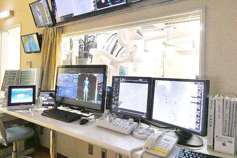 写真：血管造影検査の様子1